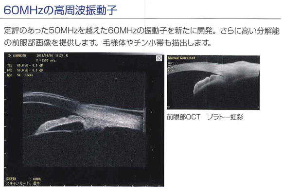 超音波生体顕微検査